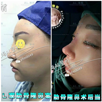 上海AL全脸打造|上海AL怎么样