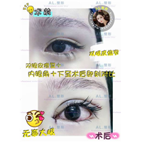 上海AL全脸打造|上海AL怎么样