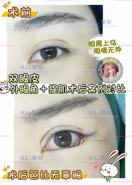 上海AL全脸打造|上海AL怎么样