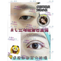 上海AL吸脂瘦身|上海AL全脸打造