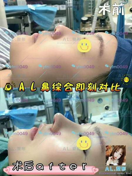 上海AL怎么样|上海人气网红整形