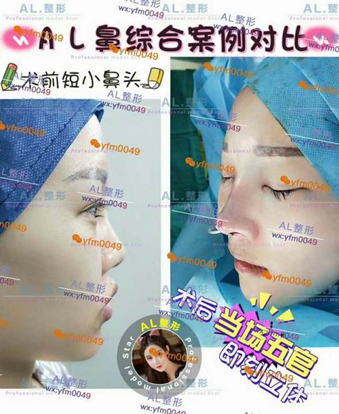 上海AL鼻综合|上海AL眼综合