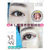 上海AL吸脂瘦身|上海AL全脸打造