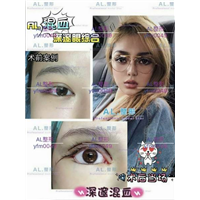 上海AL全脸打造|上海AL怎么样