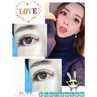 上海AL吸脂瘦身|上海AL全脸打造