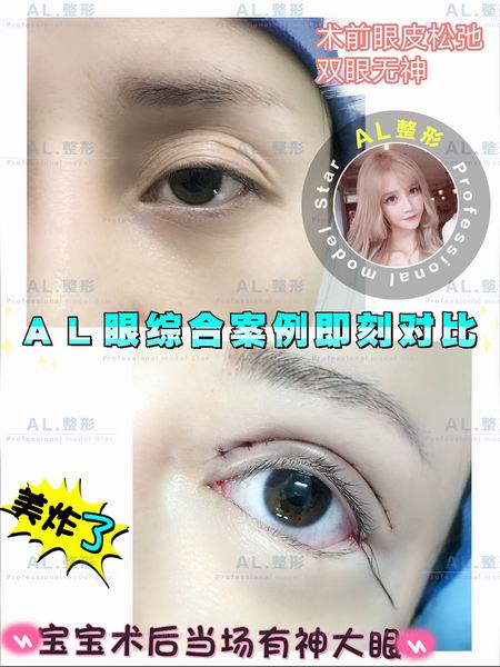 上海AL吸脂瘦身|上海AL全脸打造