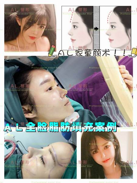上海AL鼻综合|上海AL眼综合