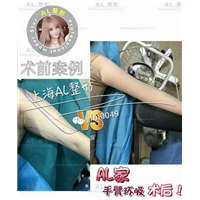 上海AL鼻综合|上海AL眼综合