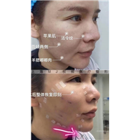 金晓东