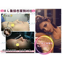 上海AL鼻综合|上海AL眼综合