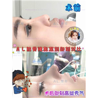 上海AL全脸打造|上海AL怎么样