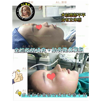上海AL鼻综合|上海AL眼综合