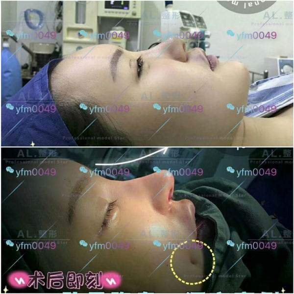 上海AL全脸打造|上海AL怎么样