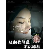 上海AL怎么样|上海人气网红整形