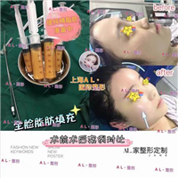 上海AL整形|上海AL鼻综合