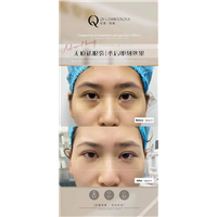 广州轻雅整形