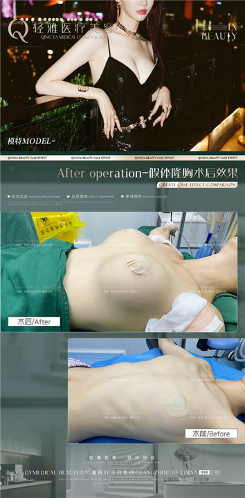 广州网红整形修复