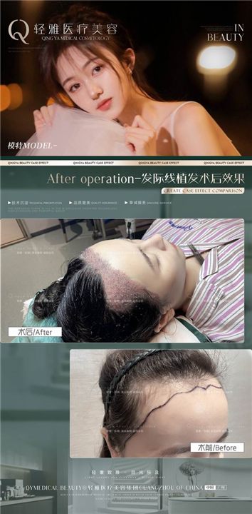 广州轻雅整形