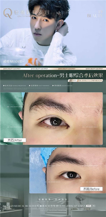广州人气网红整形