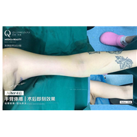 广州网红整形