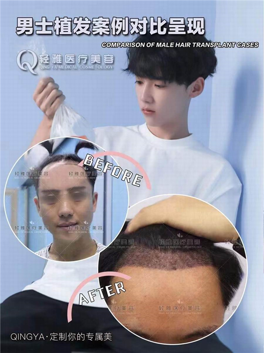 广州轻雅整形