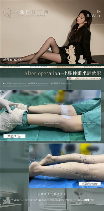 广州整形修复医院