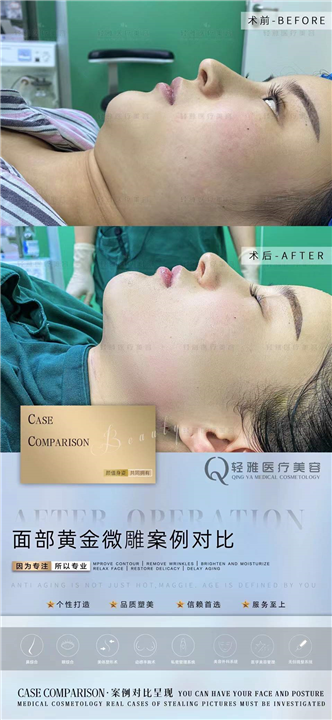 广州网红整形修复
