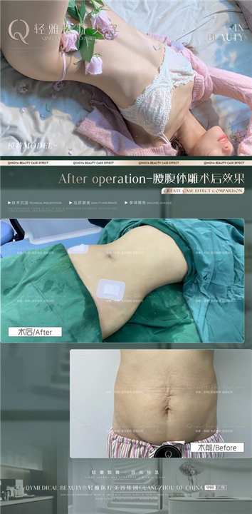 广州网红整形医院