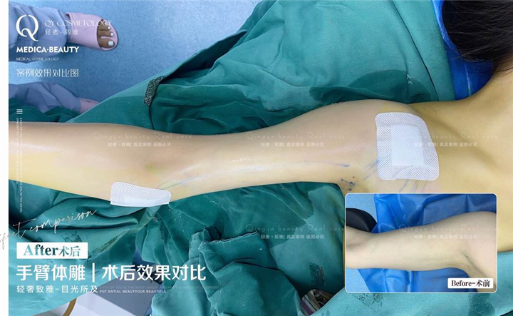 广州网红整形