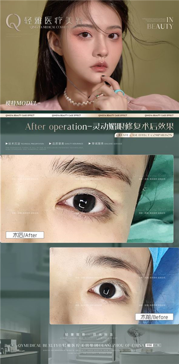 广州网红整形
