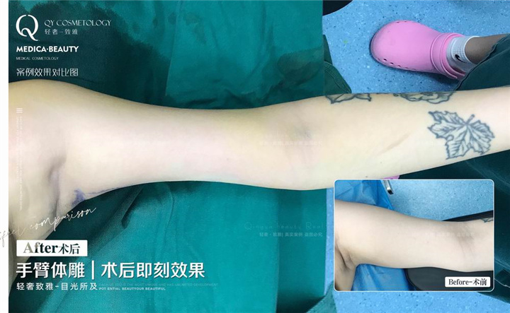 广州网红整形