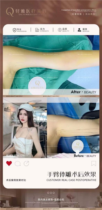 广州网红整形