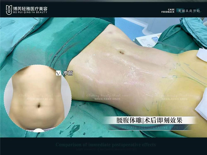 广州整形修复医院