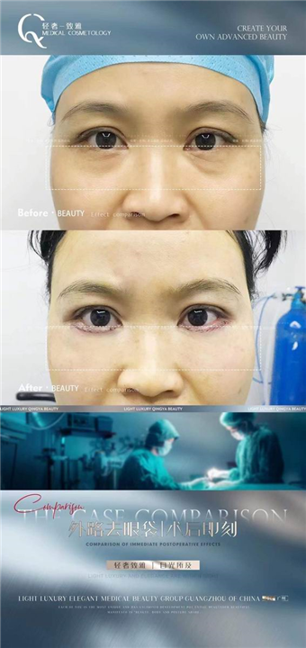 广州轻雅整形