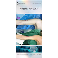 广州网红整形