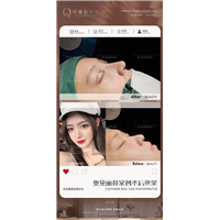 广州鼻整形修复医院