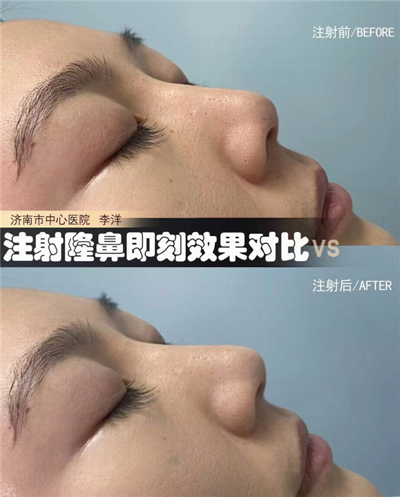 济南眼鼻整形医生