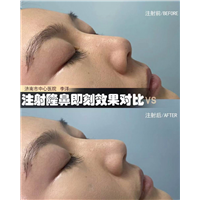 济南眼鼻整形医生