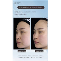 李洋医生