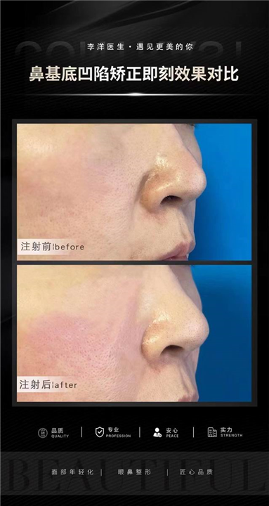 济南眼鼻整形医生