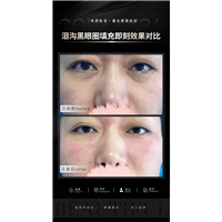 李洋医生