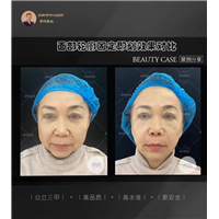济南面部年轻化医生