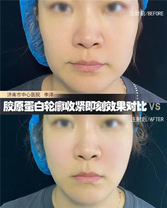 济南面部年轻化医生