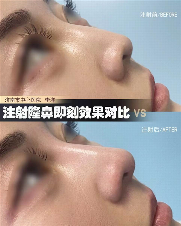济南眼鼻整形医生