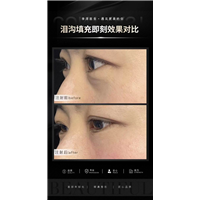李洋医生