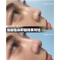 济南眼鼻整形医生