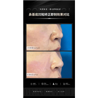 济南眼鼻整形医生
