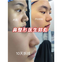郭彪医生