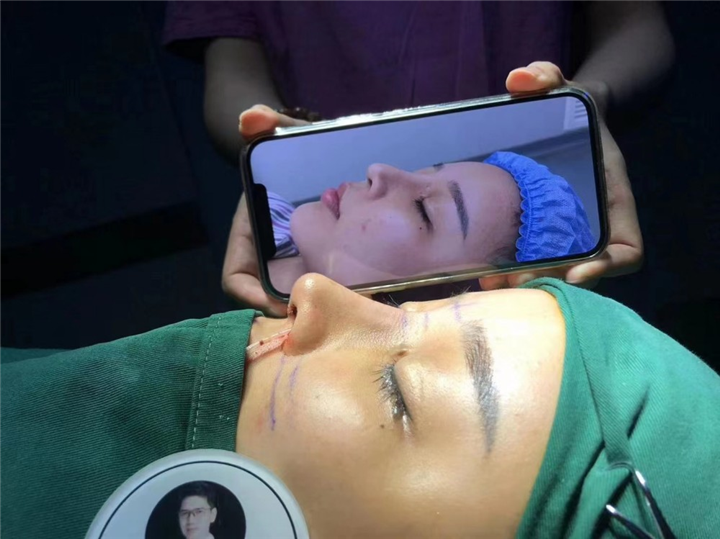郭彪做鼻子怎么样