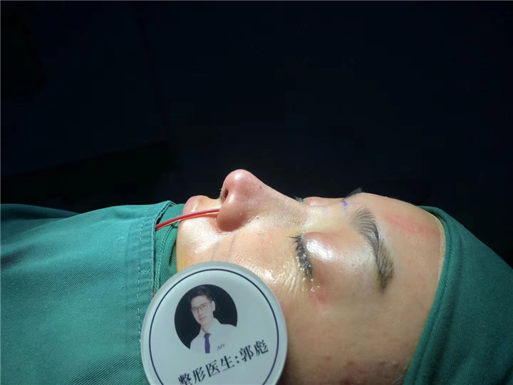 郭彪医生